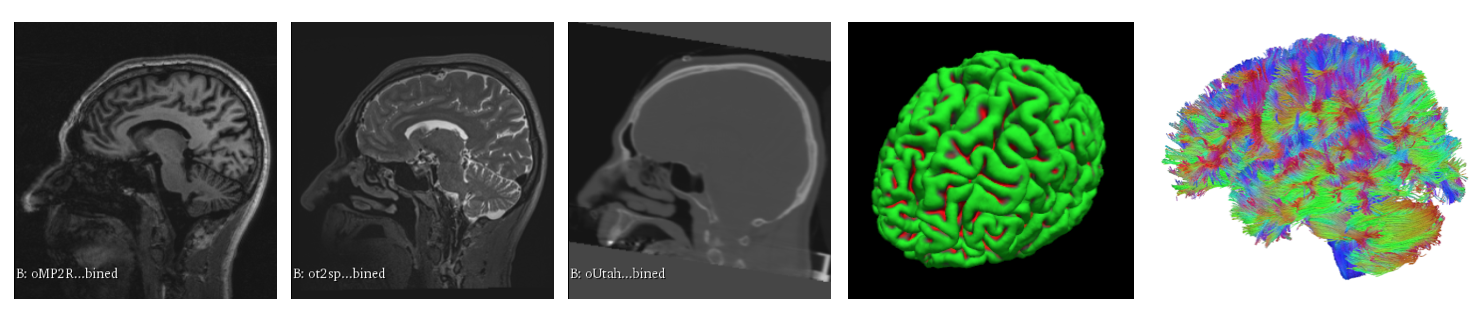 ScreenShot Images NeuroScienceInitiative Study